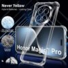 Honor Magic 7 Pro - Coque Transparente SIMEITU